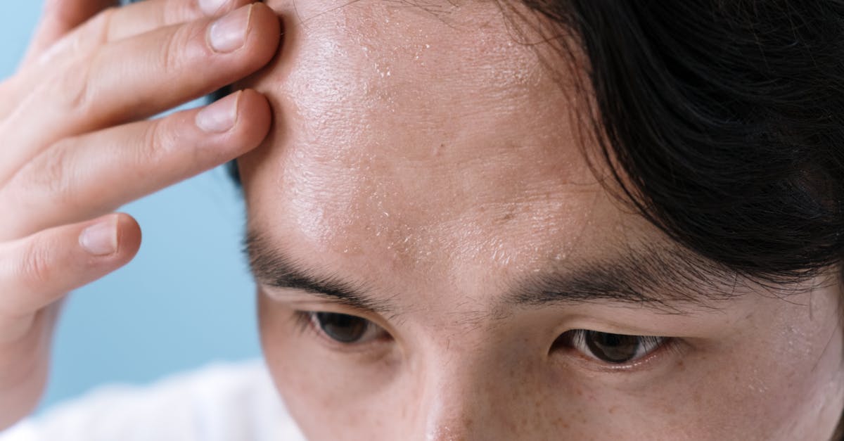Quali sono i problemi oculari comuni e i loro sintomi?