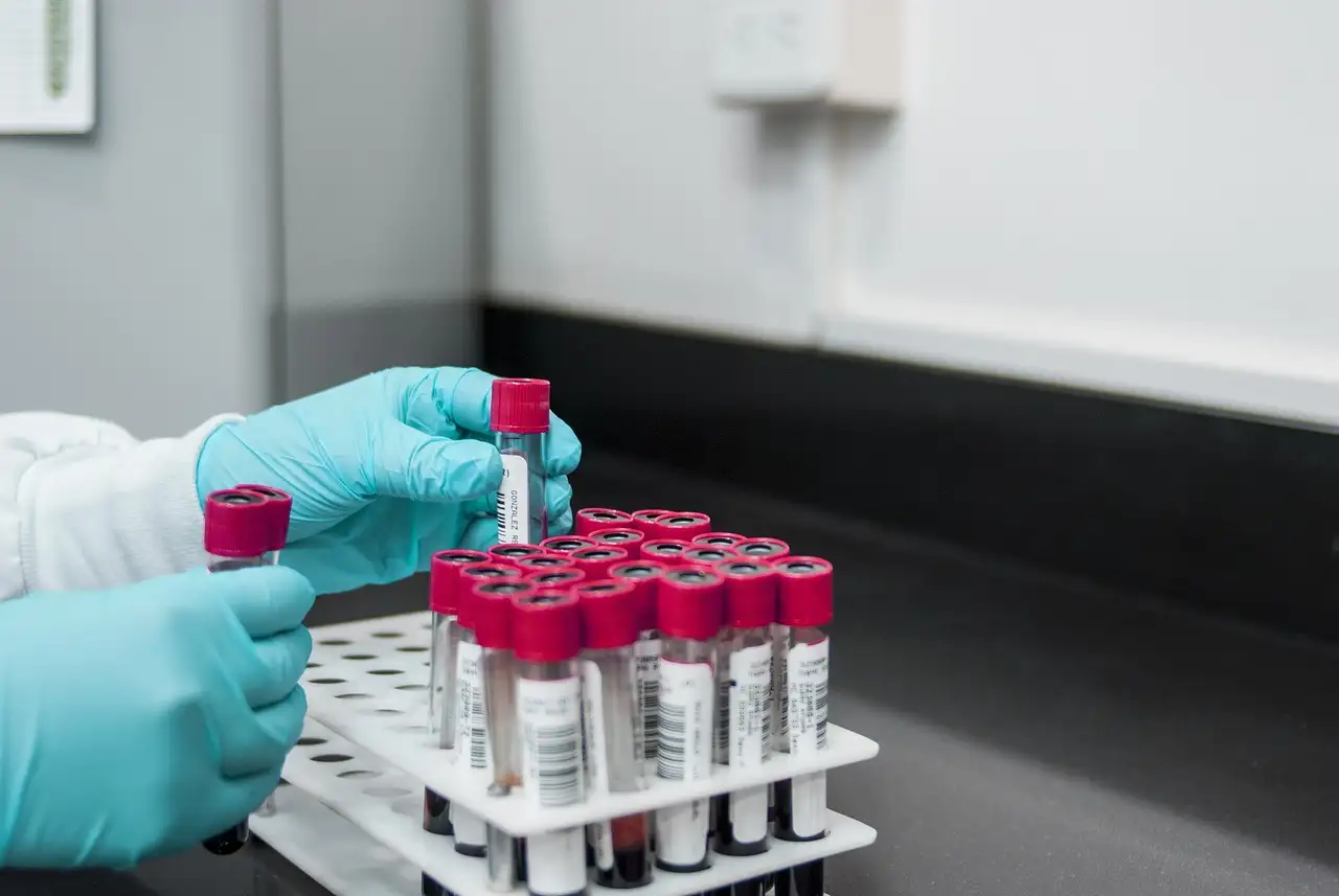 Chi ha scoperto l'urea in laboratorio?