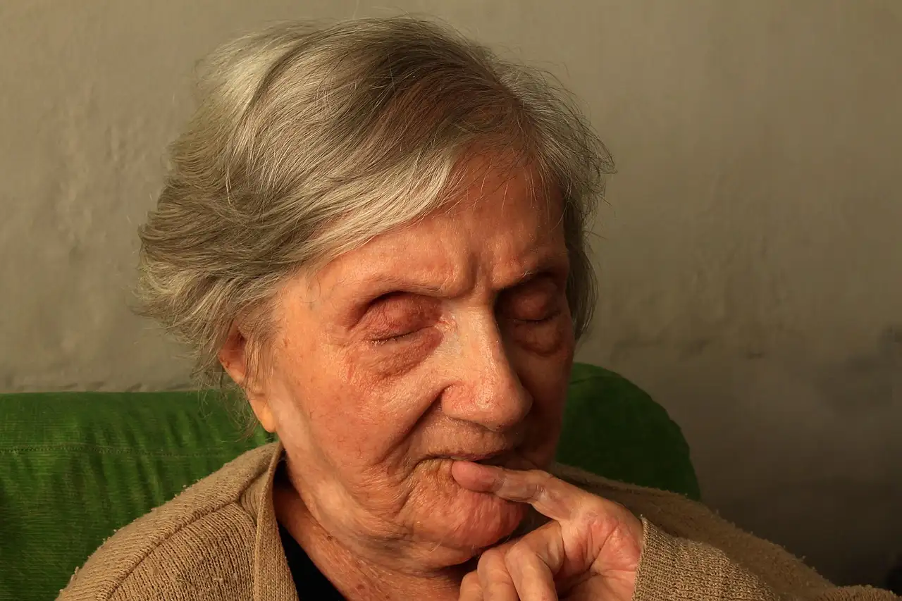 Perché i pazienti con Alzheimer dormono di più?